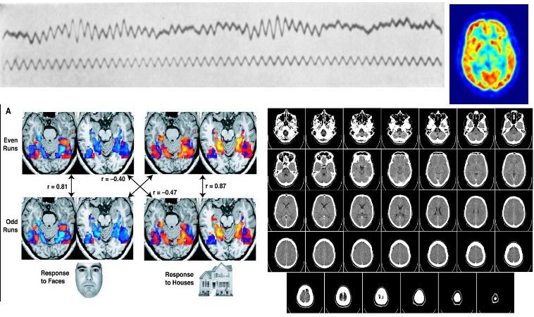 Four examples of brain scans developed in the 20th century.  Clockwise from top left:  EEG, PET scan, series of CAT scan images, series of fMRI scan images.  Sources: Wikipedia (Hans Berger, Jens Langner, Mikael Haggstrom, NIMH, all public domain).